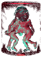 Pickled Punk, Circus Sideshows, Human Freak Show